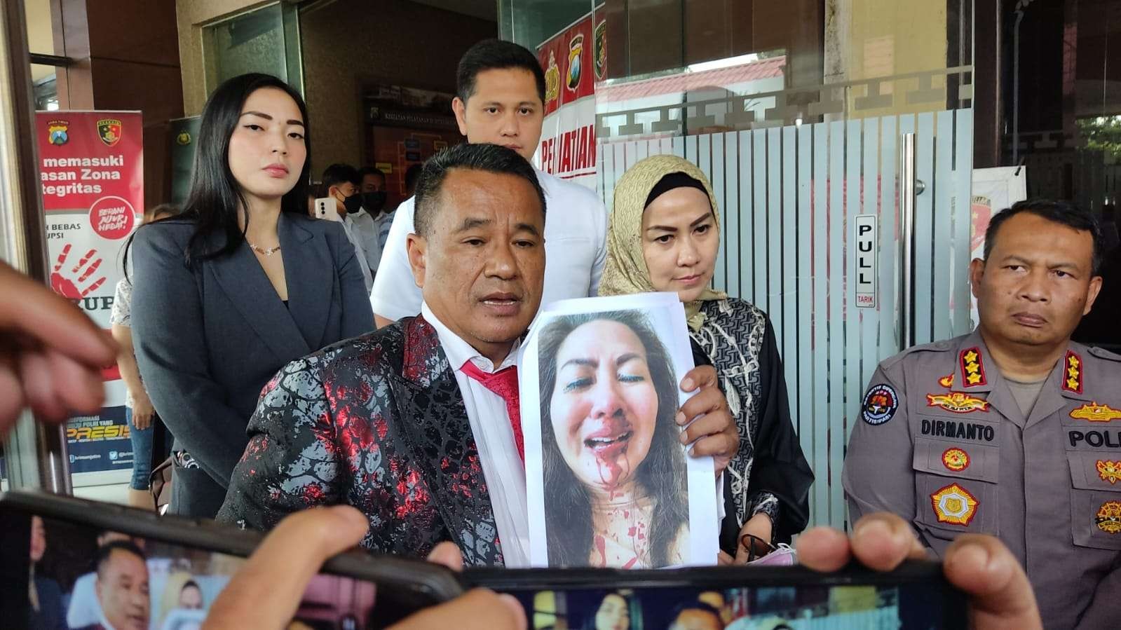 Artis Venna Melinda dan pengacaranya Hotman Paris Hutapea menunjukkan bukti kekerasan yang dialami di Mapolda Jatim, Surabaya, Kamis 12 Januari 2022. (Foto: Fariz Yarbo/Ngopibareng.id)