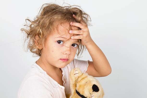 Ilustrasi campak yang banyak dialami anak-anak. (Foto: Pixabay)