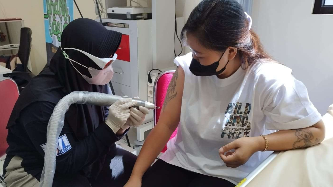 Yana sedang menjalani terapi untuk melakukan penghapusan tato (foto: Muh Hujaini/Ngopibareng.id)