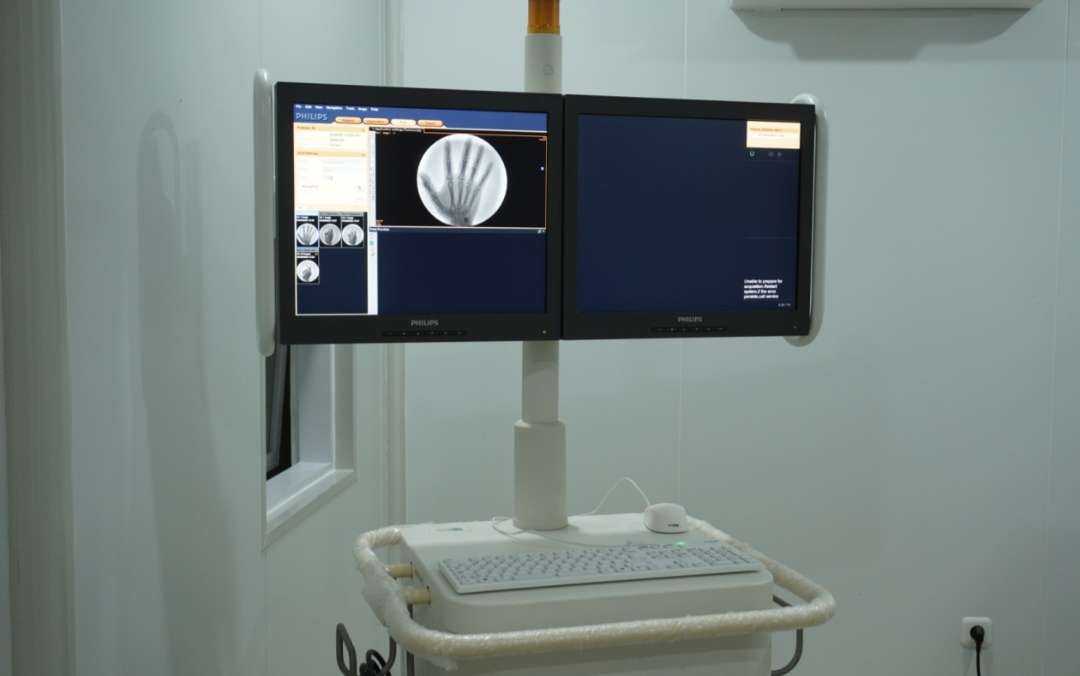 Salah satu alat penunjang layanan atasi nyeri sendi tanpa operasi, yakni radiologi C-Arm di Granostic Medical Center Surabaya. (Foto: Istimewa)