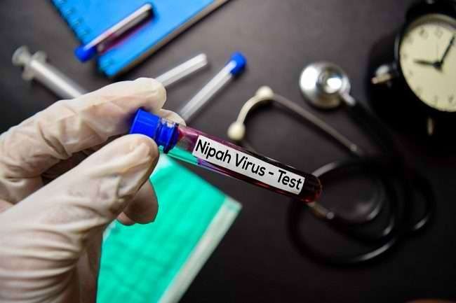 Test virus nipah.(ilustrasi alodokter)