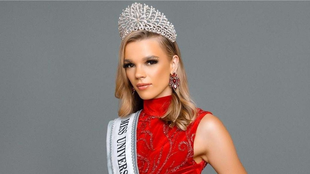 Miss Zimbabwe 2023 berkulit putih, wakil ke ajang Miss Universe. (Foto: Instagram)