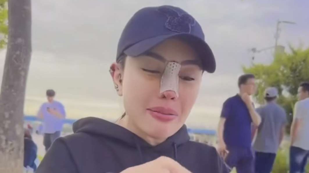 Nikita Mirzani operasi hidung di Korea Selatan. (Foto: Instagram @nikitamirzanimawardi_172)