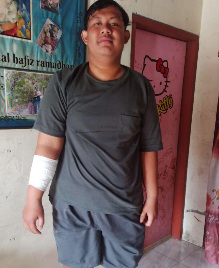 Korban pengeroyokan di Kecamatan Sambeng, Lamongan, Jawa Timur. (Foto: Istimewa)