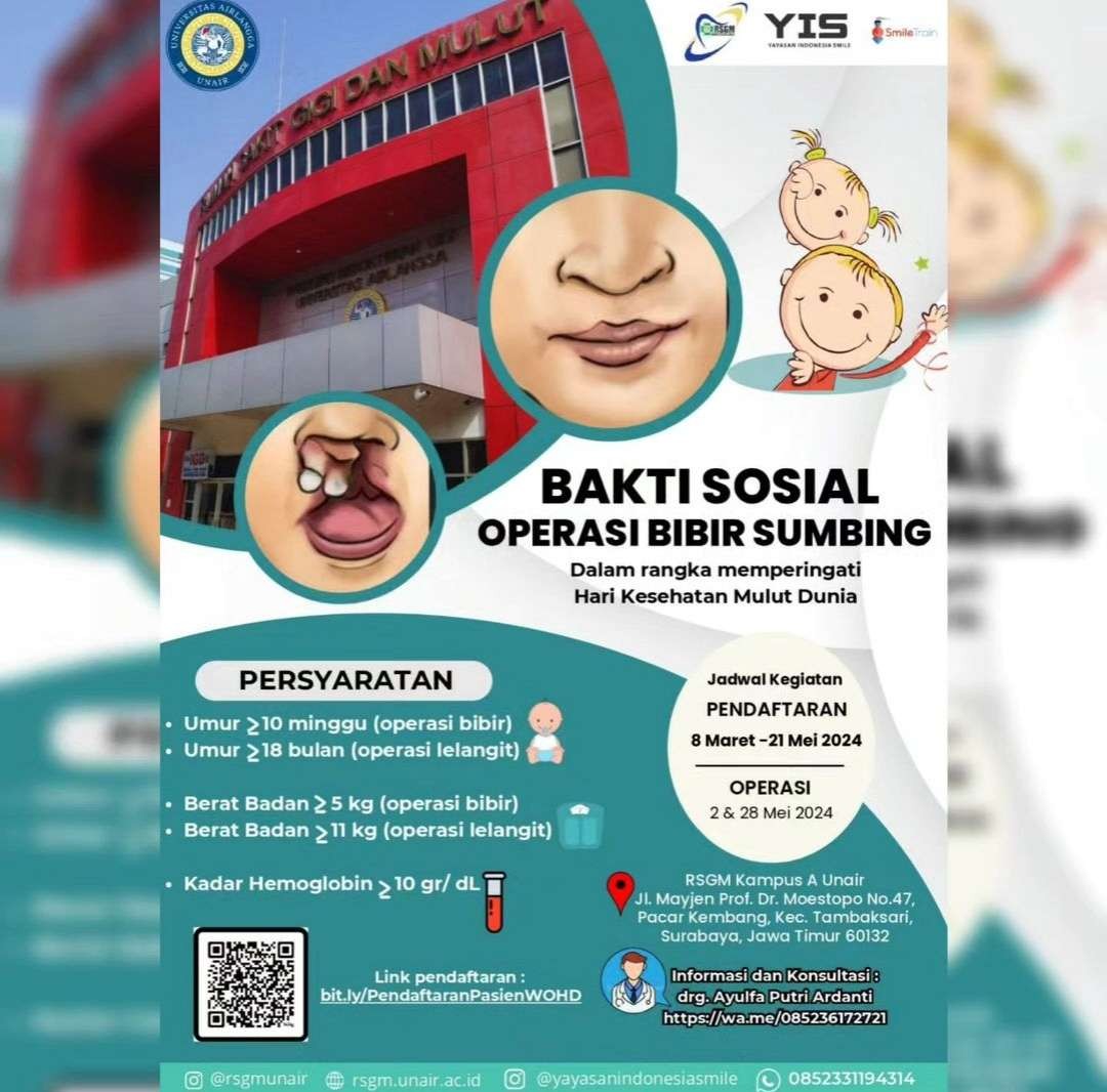 Operasi bibir sumbing RSGM Unair-YIS, daftar gratis, kuota terbatas untuk anak-anak. (Foto: Instagram @sehatsurabayaku)